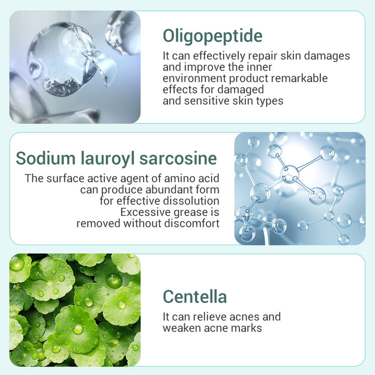فوم شستوشوی صورت ضدجوش لانبنا مدل Acne Solution وزن ۱۰۰ گرم